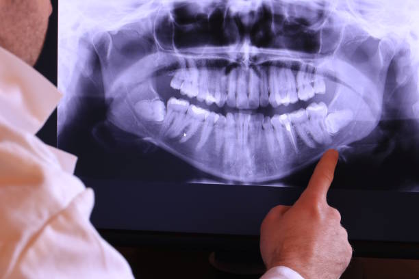 Best Emergency TMJ Treatment in West Fairview, PA
