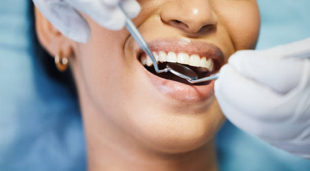 Best Emergency Dental Care for Broken or Chipped Teeth in West Fairview, PA
