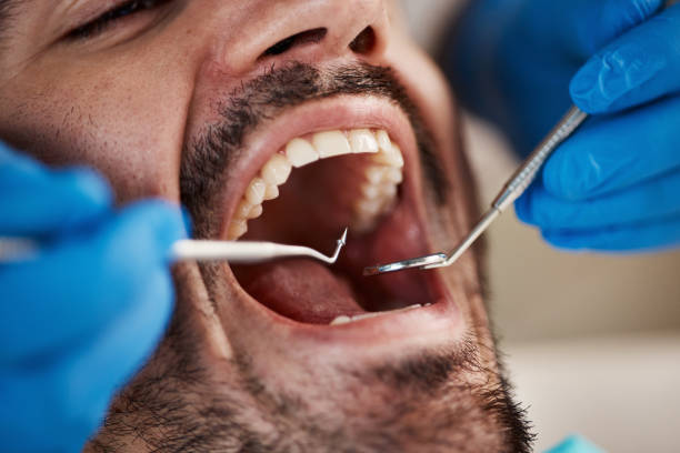 Best Emergency Wisdom Teeth Removal in West Fairview, PA
